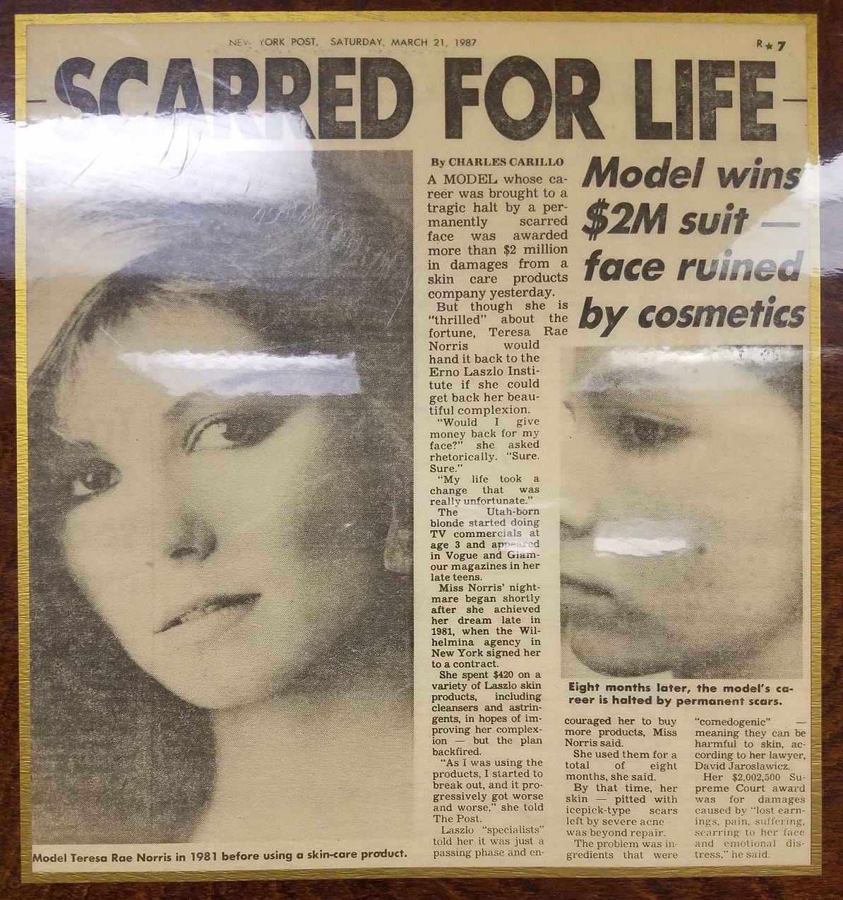 97 1987 MODEL AWARDED $2 MILLION BY JURY FOR FACIAL SCARRING FROM USE OF COSMETICS